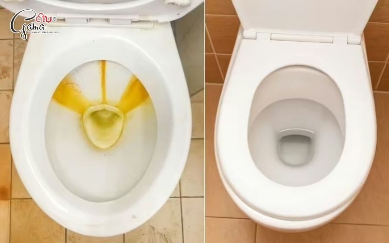 Vi khuẩn và cặn bẩn tích tụ